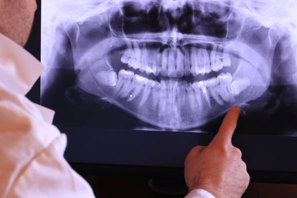 Best Emergency Treatment for Dental Infections or Abscesses in Xtonia, PA
